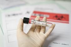 Vial labeled 'COVID-19 test' 